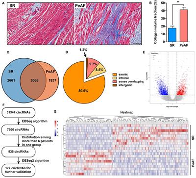 Expression Profiles of Circular RNA in Human Atrial Fibrillation With Valvular Heart Diseases